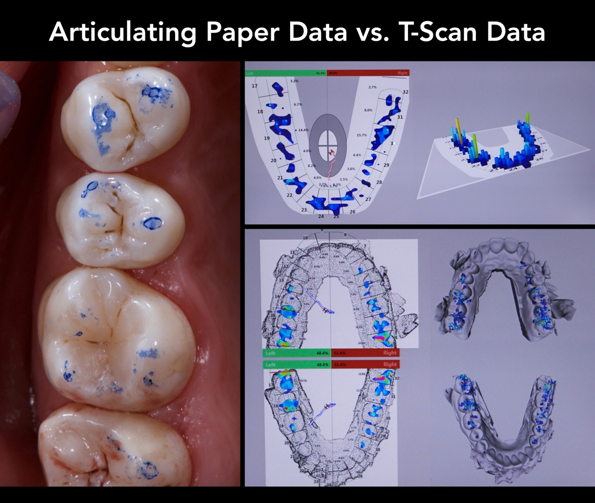 Articulation Paper